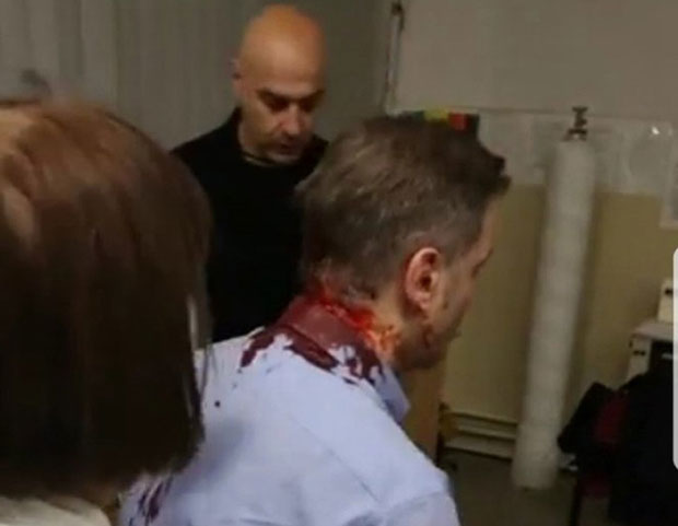  МУП: Ухапшени нападачи на Борка Стефановића 